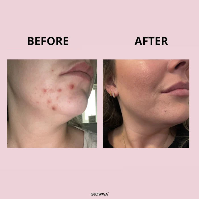 Glowwa Hair Food Original