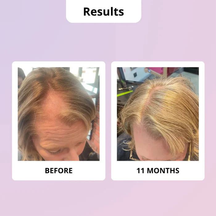 Glowwa Hair Food Menopause