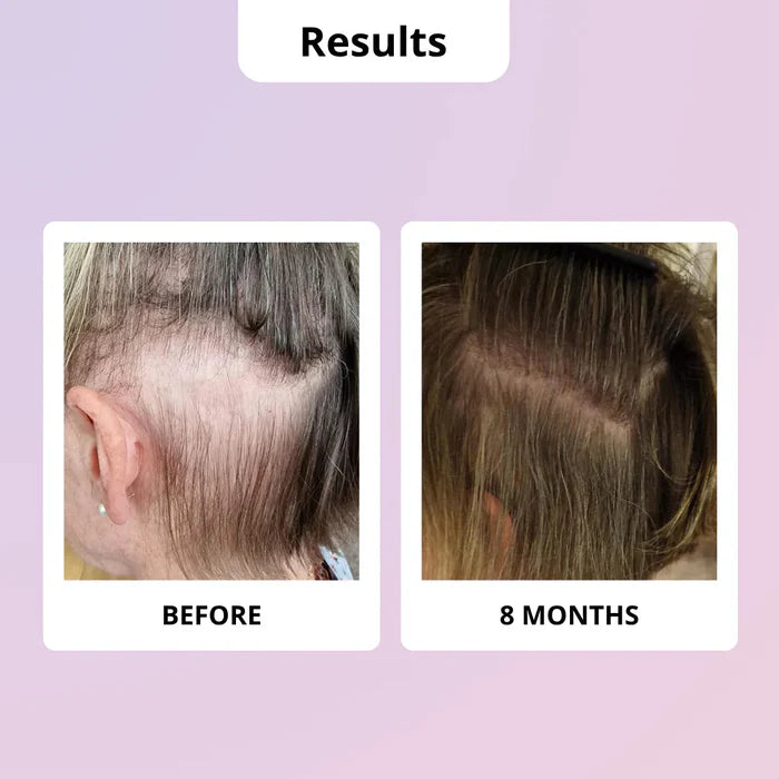 Glowwa Hair Food Menopause